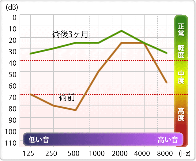 聴覚測定結果