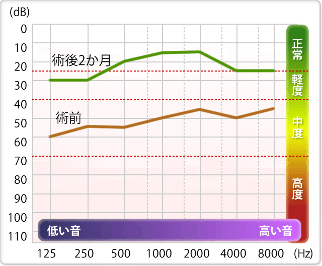 聴覚測定結果