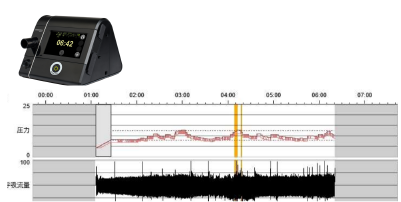 Bilevel CPAP