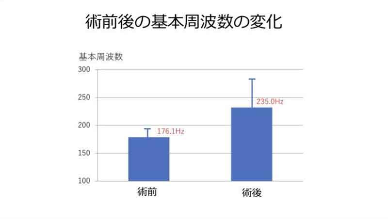 術前後の基本周波数の変化